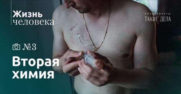 Проект "Жизнь человека" выпустил новую фотоисторию о курсе химиотерапии доктора Павленко